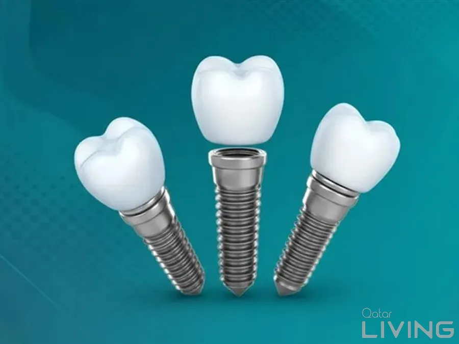 Dental Implant & 3D X-Ray Bundle